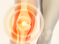 무릎 통증, 50대 이상 64%가 겪는 이유는?