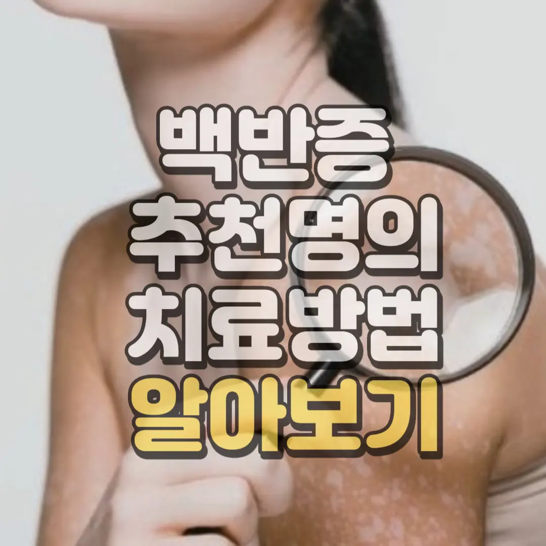 백반증 추천명의