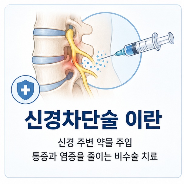 척추와 신경 주변에 약물이 전달되는 모습을 통해 신경차단술이 통증을 전달하는 신경 주변에 약물을 주입해 통증과 염증을 줄이는 비수술적 치료임을 보여 주는 그림