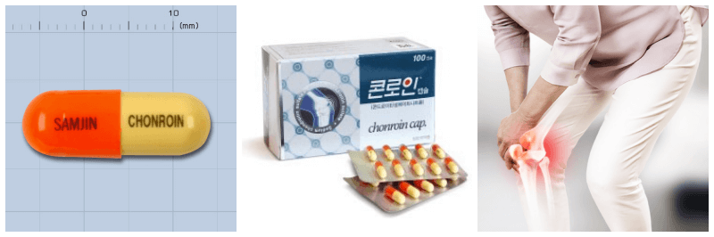 콘로인캡슐, 퇴행성 관절염 사진