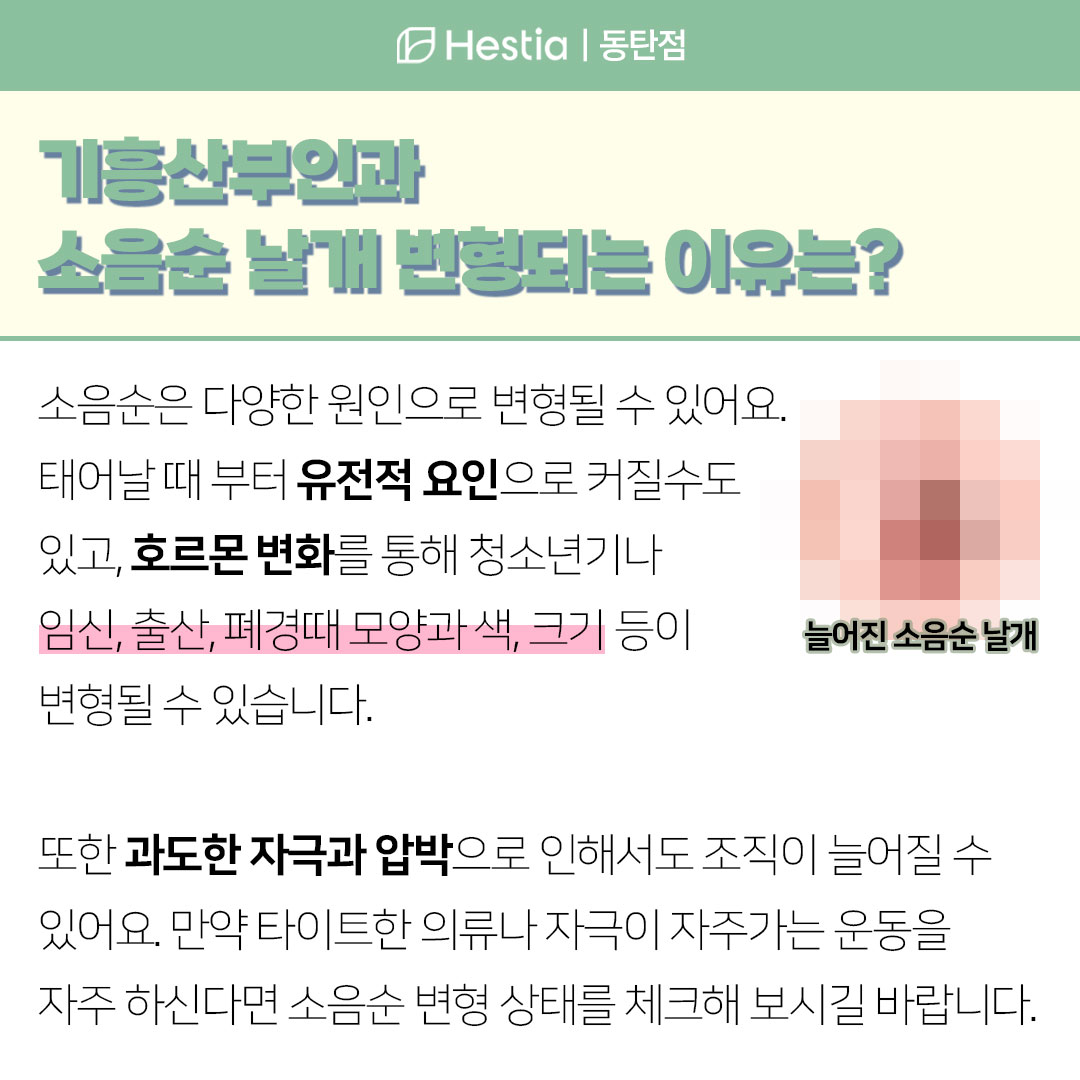 기흥산부인과 소음순 날개 소음순수술 후 부작용 소음순 날개 변형 원인
