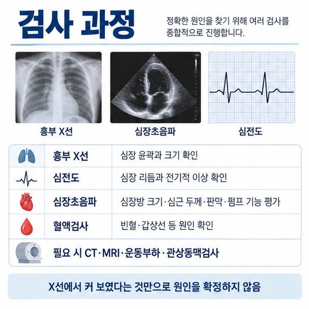 흉부 엑스선 심전도 심장초음파 혈액검사로 심장 비대의 원인을 확인하는 과정을 보여주는 이미지
