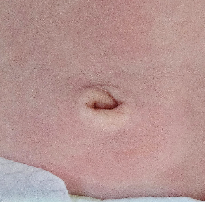 신생아 배꼽 탈락 전후 관리법 진물이나 냄새날 때 대처하기