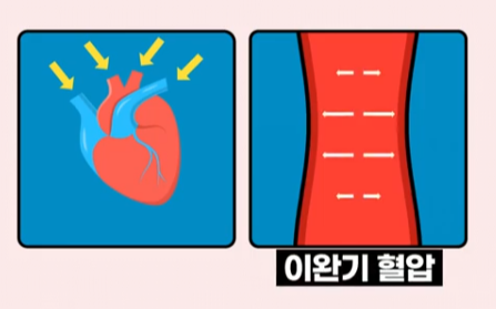 혈압의 정의