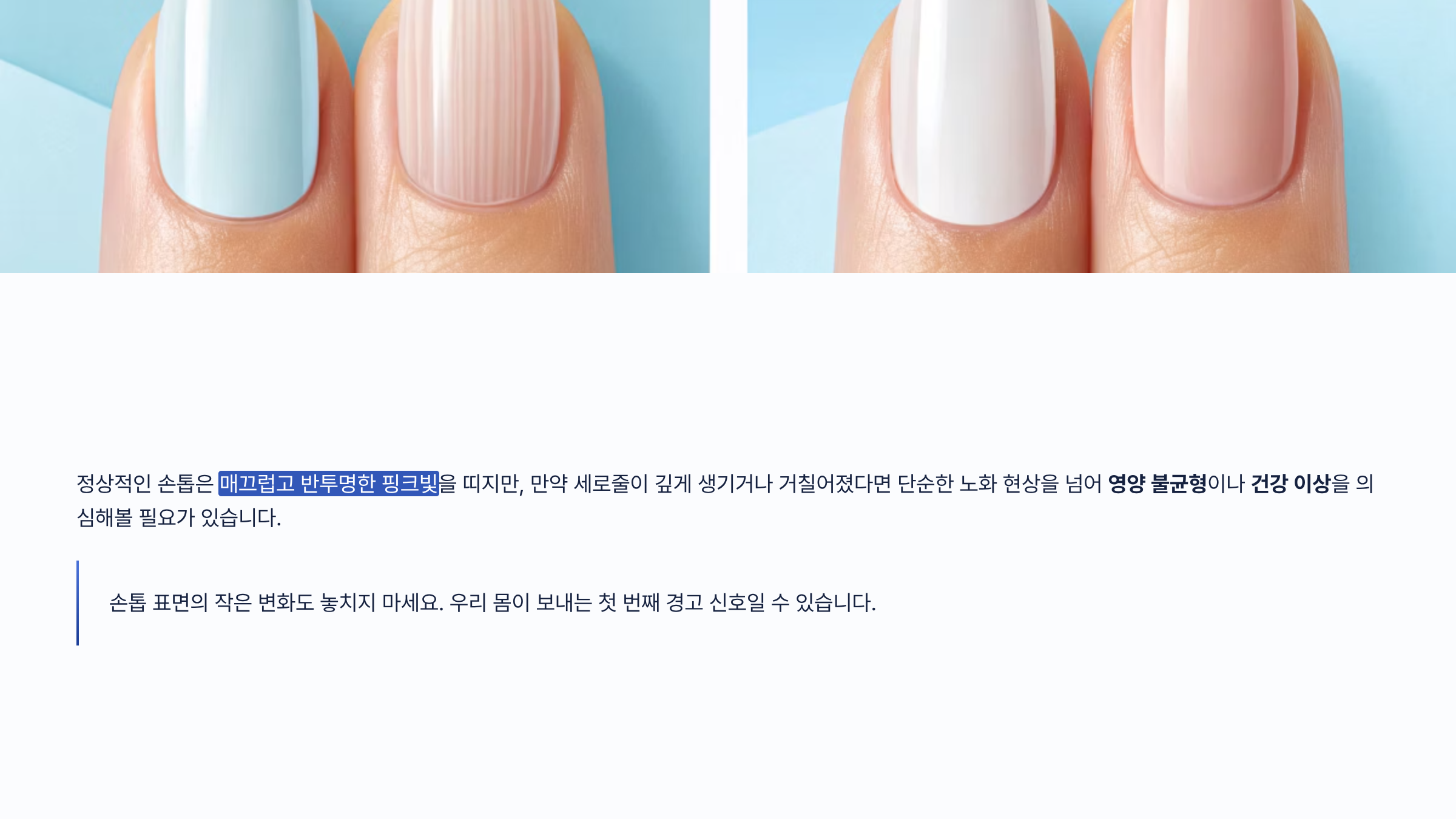 손톱에 세로줄이 생기는 이유 총정리