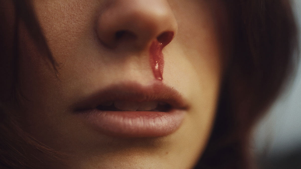 “코피-자주-나는-이유”