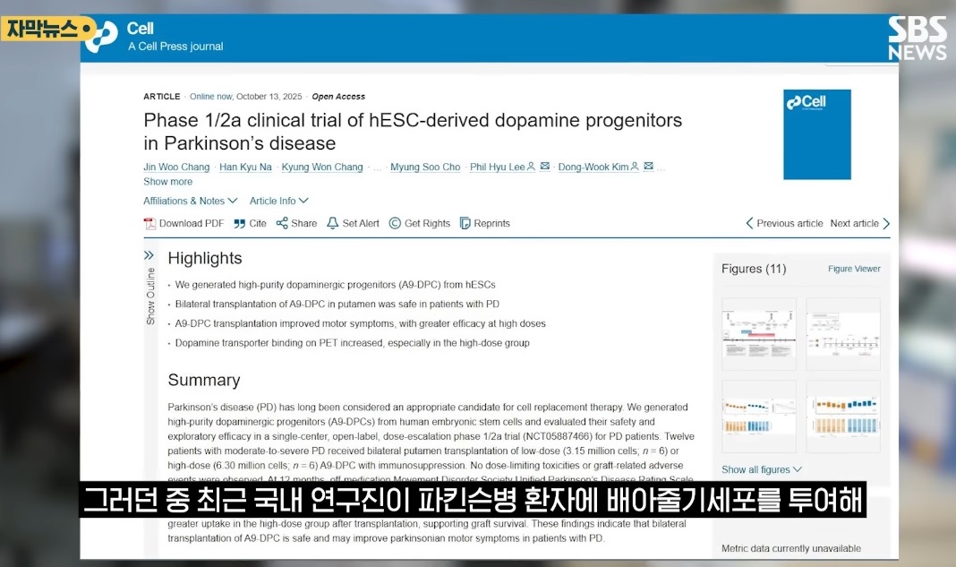EBS-명의-파킨슨-신경외과
