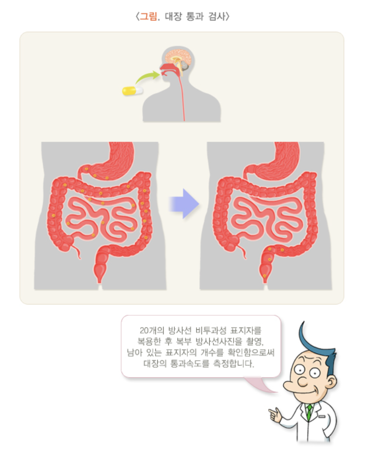 대장 통과 시간 검사