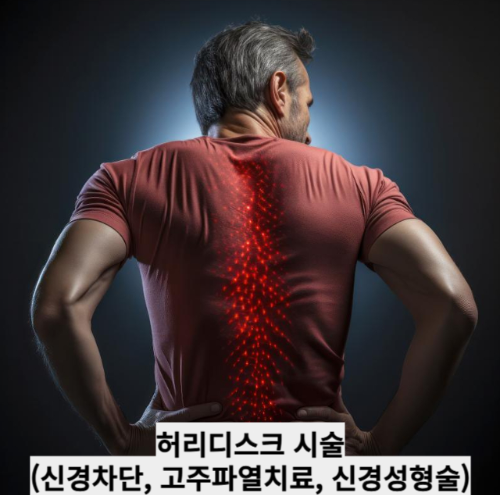 허리디스크 시술(신경차단, 고주파열치료, 신경성형술)
