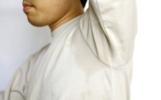 다한증 치료 원인 수술 다한증에 좋은 음식 총정리