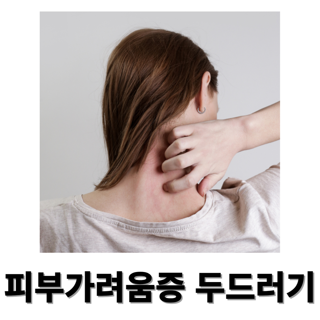 피부가려움증과 관련된 사진입니다.