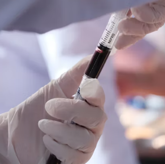 대상포진 치료방법 진단 기준 합병증