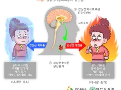 갑상선 이미지