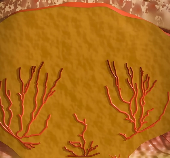 곤지름 초기증상