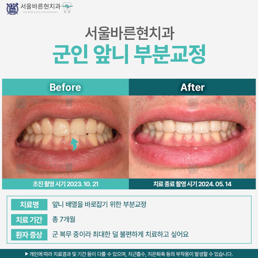 부산군인교정