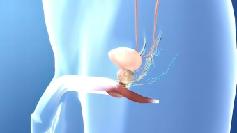 전립선암 