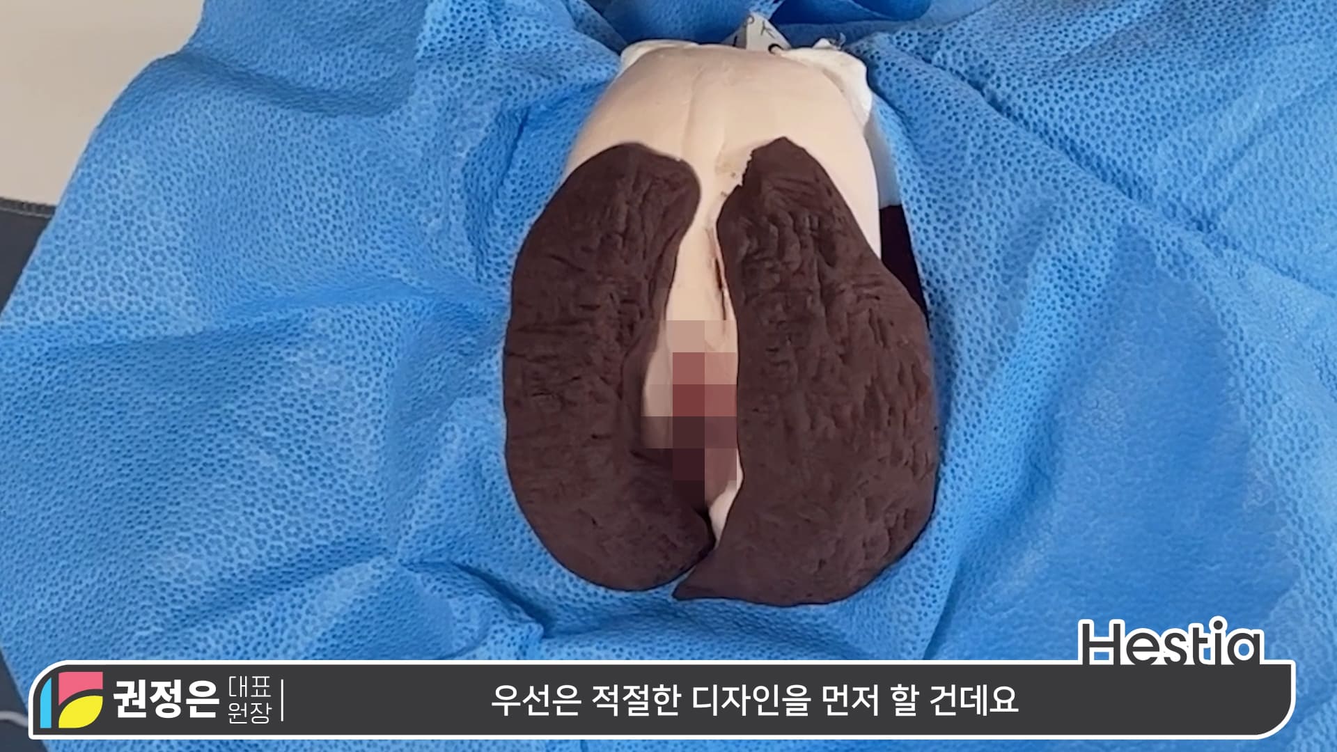 대음순성형수술 시물레이션