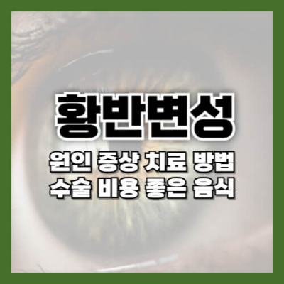 황반변성 원인
황반변성 증상
황반변성 치료법
황반변성 좋은 음식
황반변성 예방
황반변성 자가진단 방법
황반변성 수술 비용
연령 관련 황반변성
눈 건강에 좋은 음식
망막 보호 음식
루테인 식품
오메가-3 눈 건강
비타민 C 눈 보호
비타민 E 눈 건강
아연 함유 식품
카로티노이드 눈 건강
자외선 눈 보호
담배가 눈에 미치는 영향
고혈압 눈 건강
당뇨병과 황반변성
암슬러 격자 테스트
안구 주사 치료
황반변성 레이저 치료
광역학 치료 황반변성
황반변성 예방식단
황반변성 실명 예방
정기적인 안과 검진
눈 건강 관리법
황반변성 초기증상
눈 건강 영양제