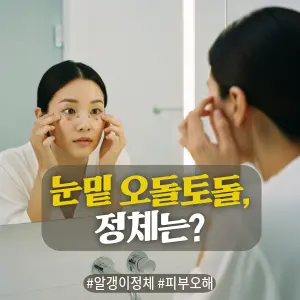 * 이미지 프롬프트: 밝은 자연광이 가득한 주방. **50대 한국인 여성(이목구비가 뚜렷하고 깨끗한 이미지의 얼굴)**이 테이블에 앉아, 앞에 놓인 건강한 연어 샐러드(신선한 채소, 베리류, 견과류 포함)를 보며 만족스럽고 편안한 미소를 짓고 있다. 전체적으로 밝고 따뜻하며 부드러운 색감. 필름 카메라로 촬영한 듯한 자연스러운 빛 번짐과 미세한 필름 그레인 효과를 더해 아날로그 감성을 연출한 극사실주의 사진 스타일.
* 썸네일 텍스트(제목): 눈 밑 오돌토돌, 정체는?
* 해시태그: #알갱이정체 #피부오해