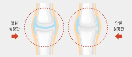 성장판 닫혀도 키 클 수 있는 방법과 성장 호르몬 시기_1