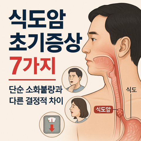 식도암 초기증상을 설명하는 의료 일러스트