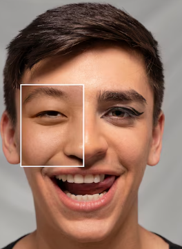 구안와사 초기증상 17