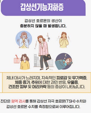 갑상선기능저하증