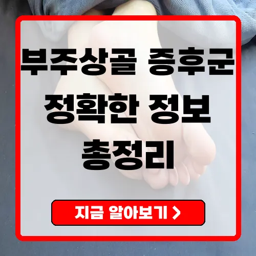 부주상골증후군