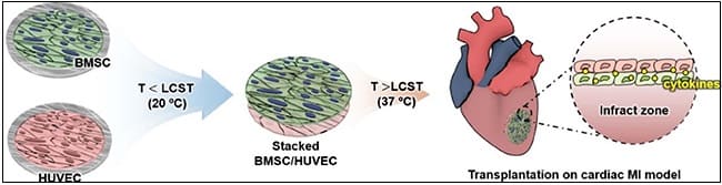 포스텍 연구팀, 심장에 딱 붙는 심근경색 치료 패치 개발