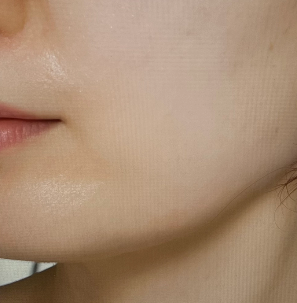 대웅제약-이지듀-리프트-코어-앰플-내돈내산-후기-작성위해-찍은-제품-사진