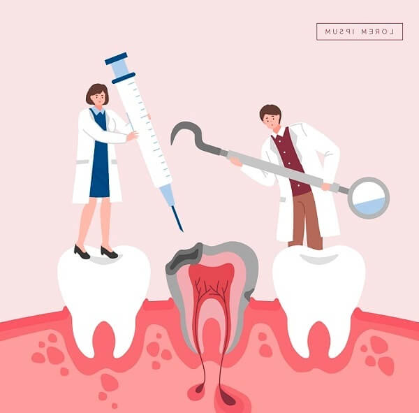 치과치료 일러스트