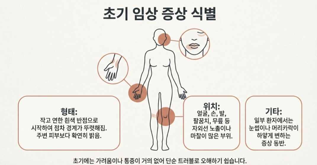 백반증원인-사진7