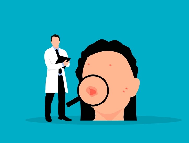 건선에 관련된 사진