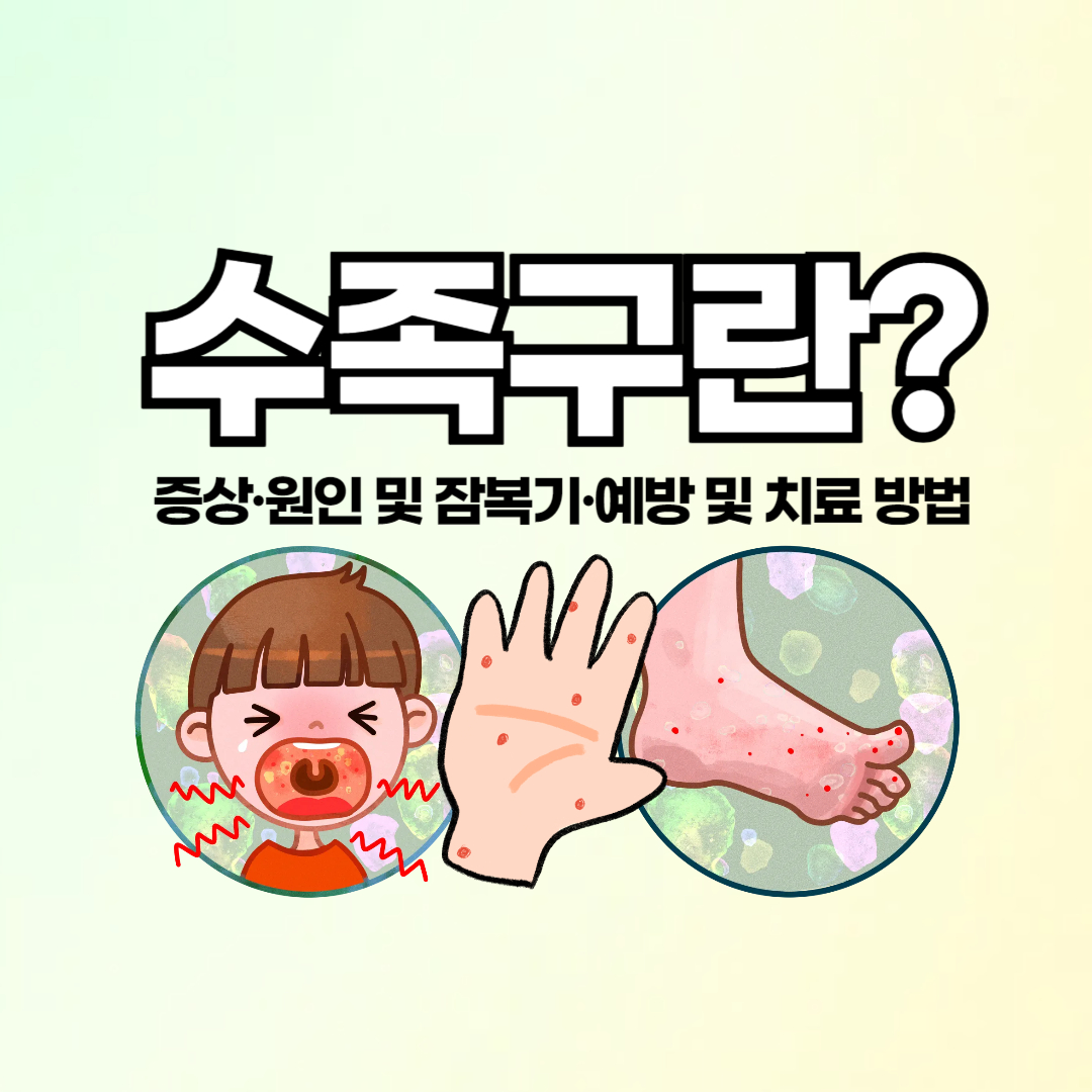 수족구 증상 잠복기 감염경로 예방 및 치료방법