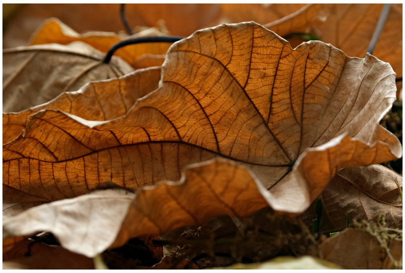 쇼그렌 증후군(Sjögren’s Syndrome), 단순한 건조 증상을 넘어서는 자가면역질환