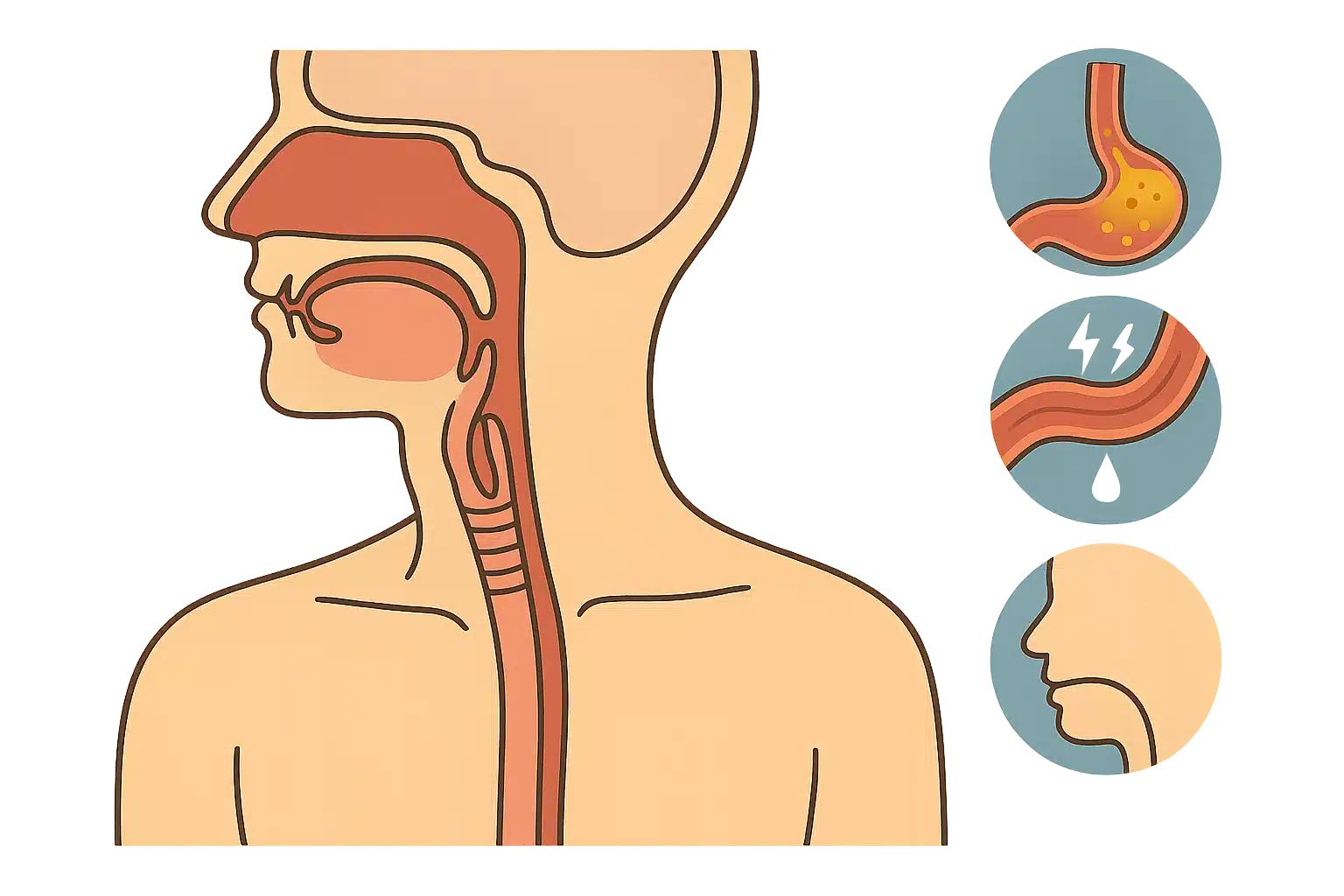 위산 역류, 근육 긴장, 후비루, 공기 삼킴