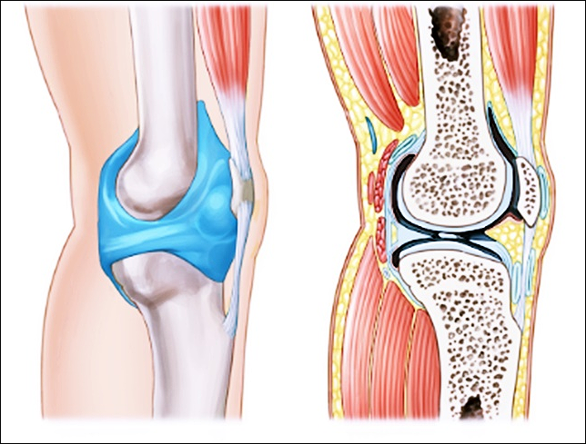 종근당 이모튼 캡슐 가격 부작용