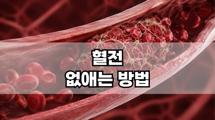 혈전 없애는 방법