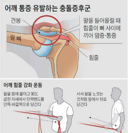 어깨 통증 원인