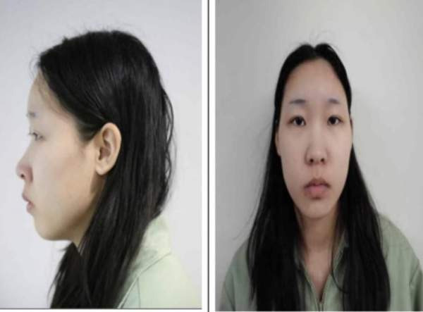 모텔 살인 김소영 사이코패스