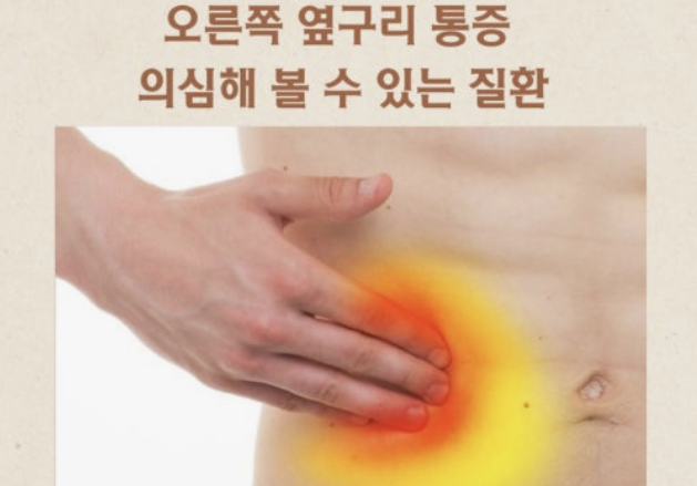 오른쪽 옆구리 통증 의심되는병