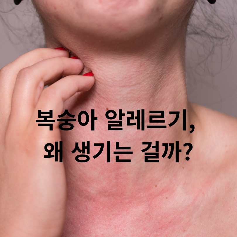 복숭아 알레르기 원인, 증상, 대처법