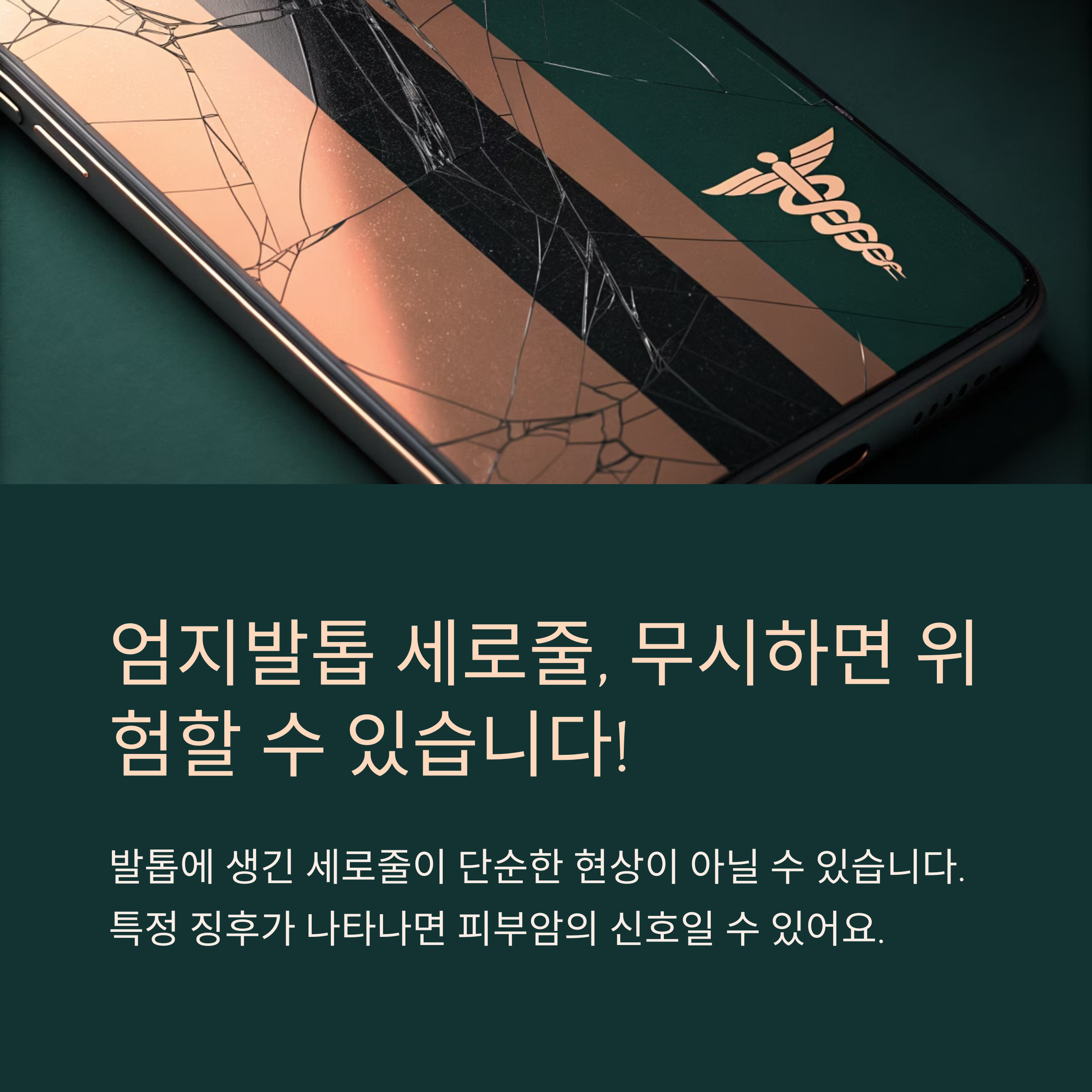 엄지발톱 세로줄