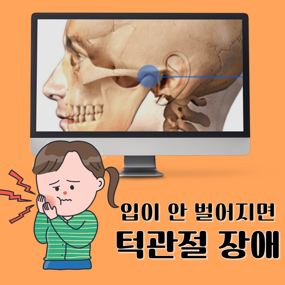 턱관절 증상