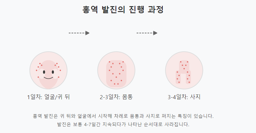 홍역 발진의 진행 과정
