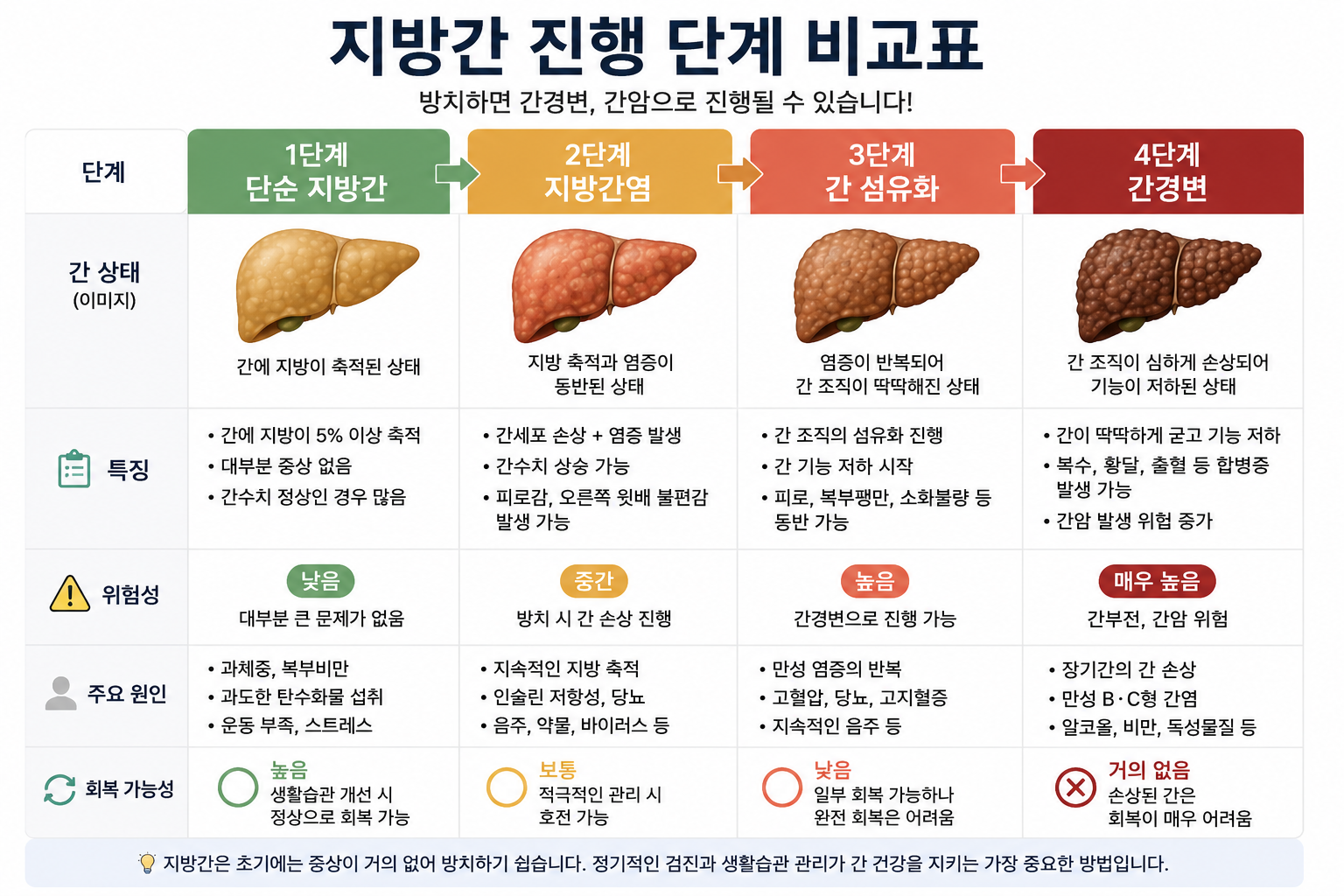 지방간에서 지방간염·간섬유화·간경변까지 진행되는 단계와 특징을 비교한 간질환 진행 비교표 이미지