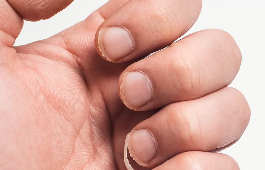 손톱이 잘 부러지는 이유