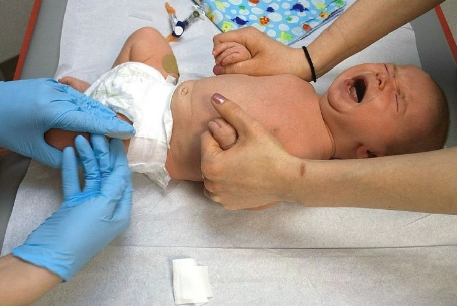 어린 아이가 경기를 하면서 크게 울고 있는 것을 엄마와 의사가 팔과 다리를 잡고, 다리에 링거를 놓으려고 하고 있는 것을 찍은 사진