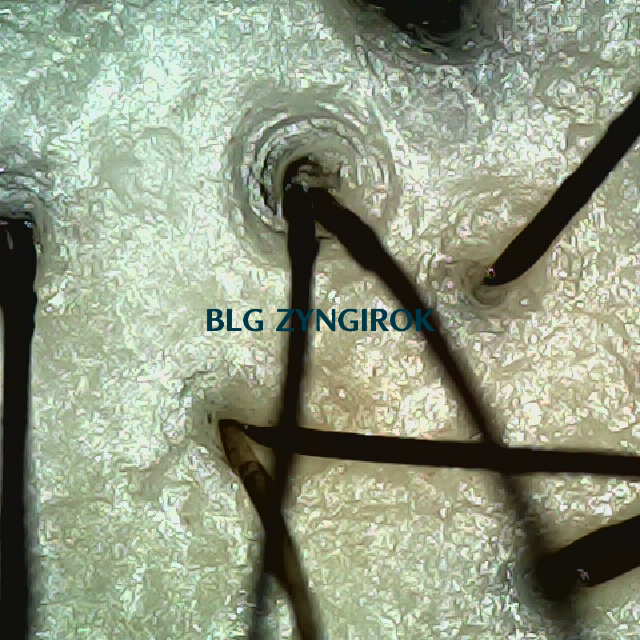 탈모 극복 프로젝트 - 정수리 두피 모습이다.