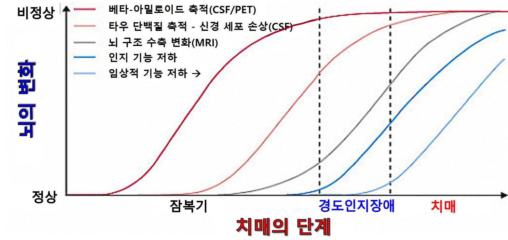 치매